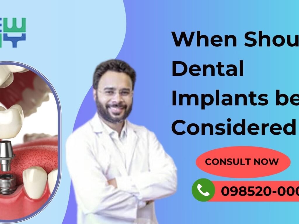 When should someone think about getting dental implants