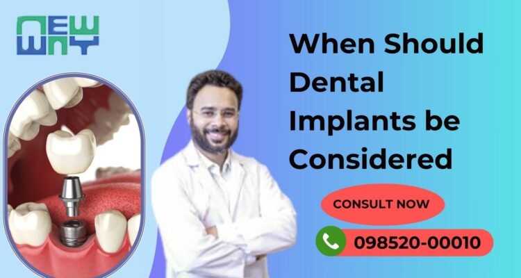 When should someone think about getting dental implants