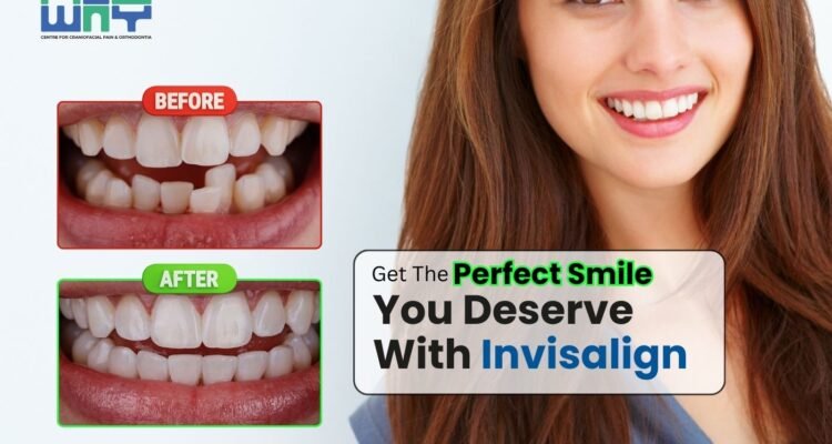 Invisalign Doctor in Chandigarh