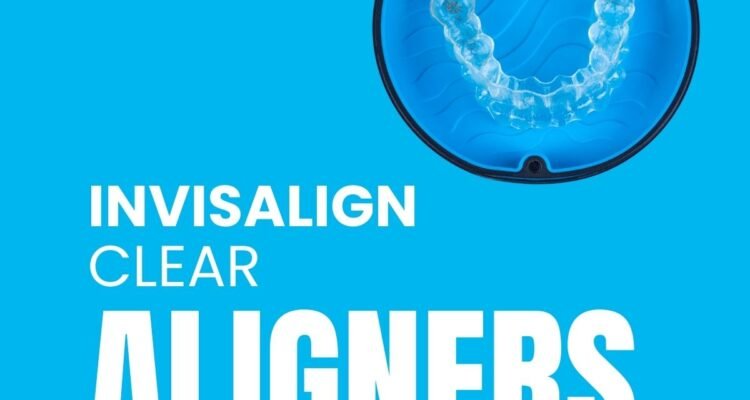 invisalign clear aligners
