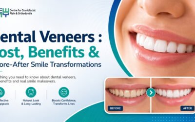 Dental Veneers in Chandigarh