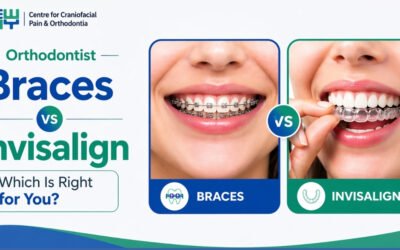 Orthodontist in Chandigarh