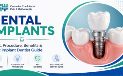 dental implants Chandigarh