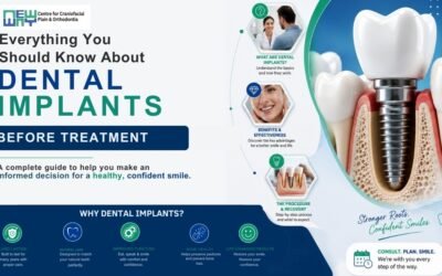 Dental Implants in Mohali