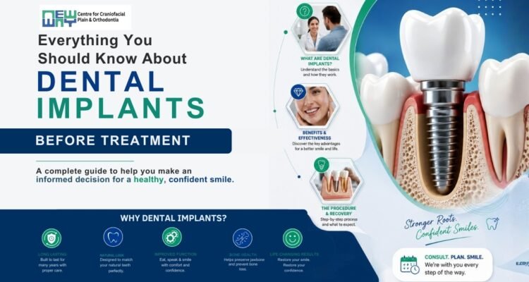 Dental Implants in Mohali