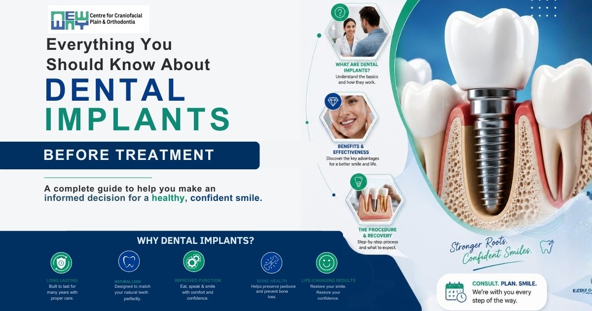 Dental Implants in Mohali