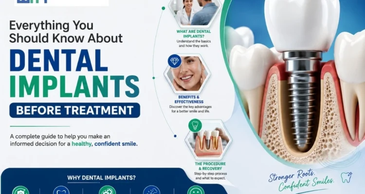 Dental Implants in Mohali