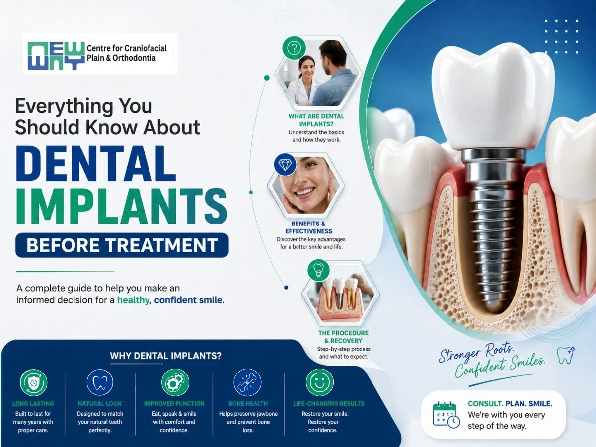Dental Implants in Mohali