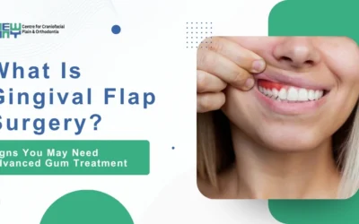 Gingival Flap Surgery in Chandigarh