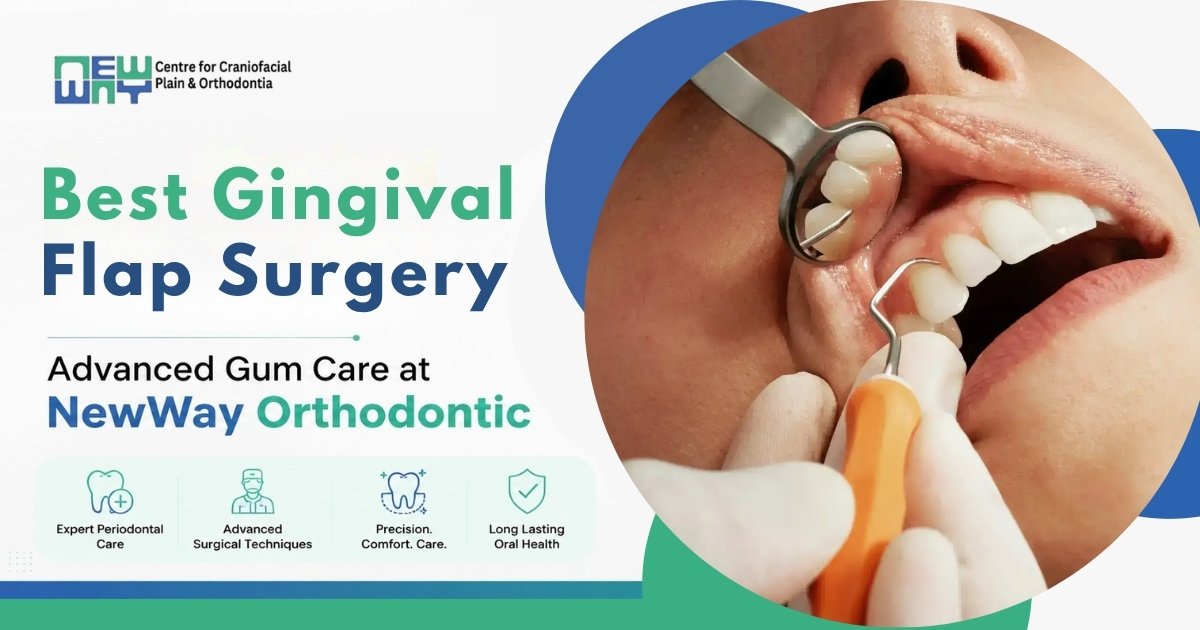 Gingival Flap Surgery in Chandigarh