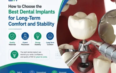 best dental implants in Chandigarh