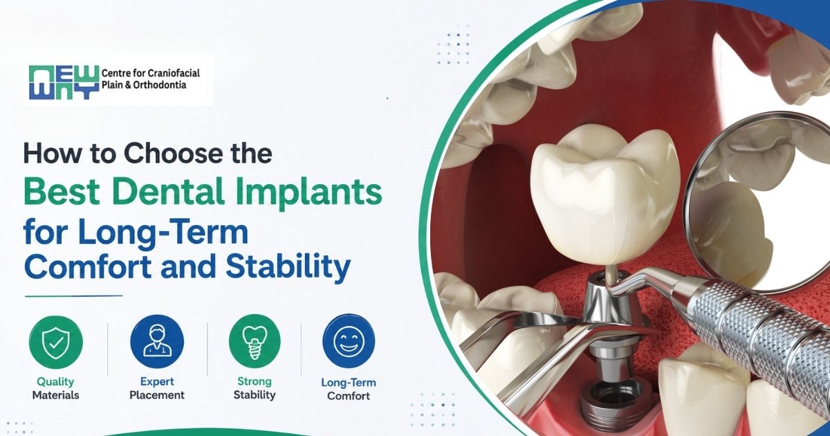 best dental implants in Chandigarh