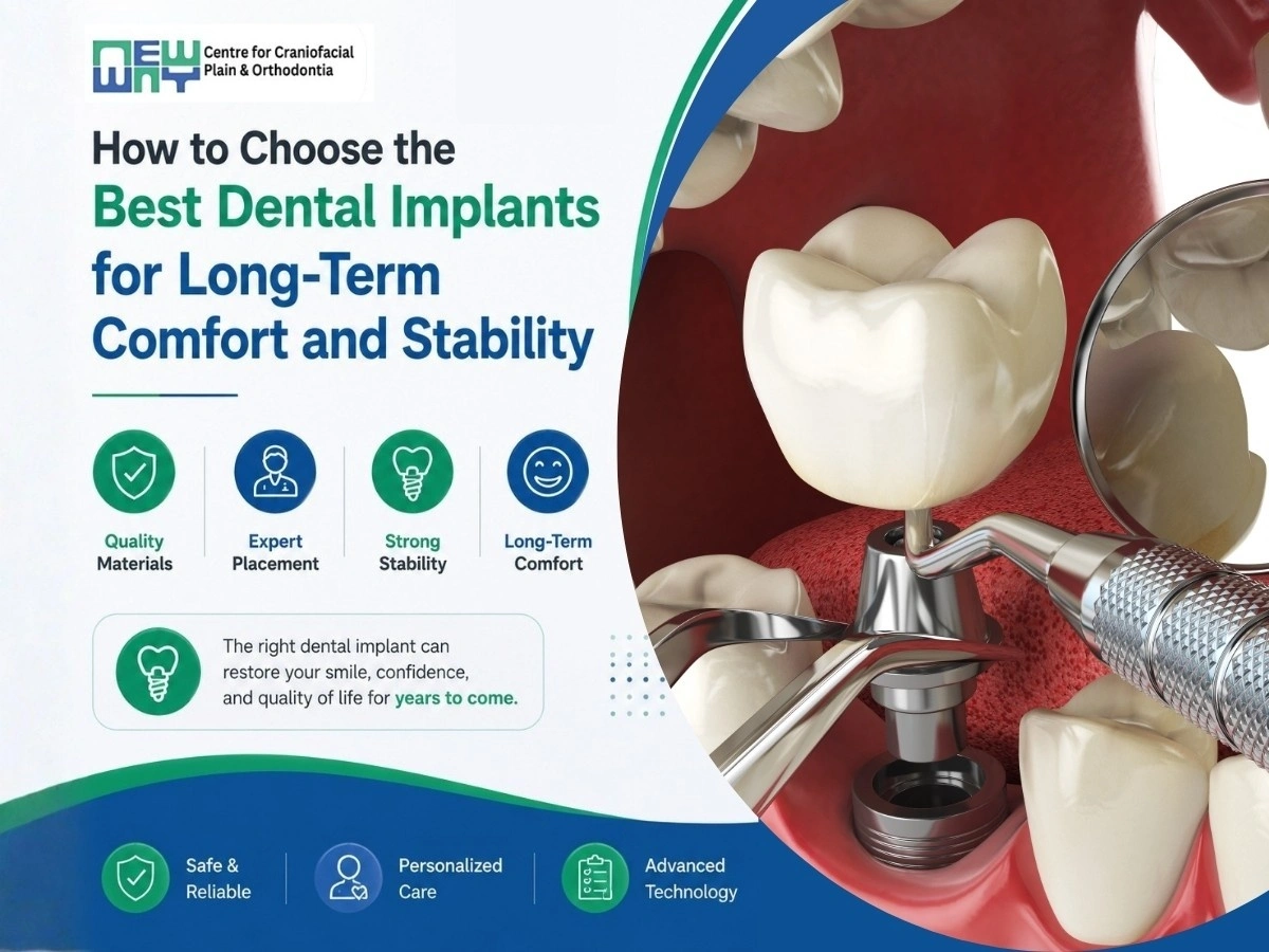 best dental implants in Chandigarh