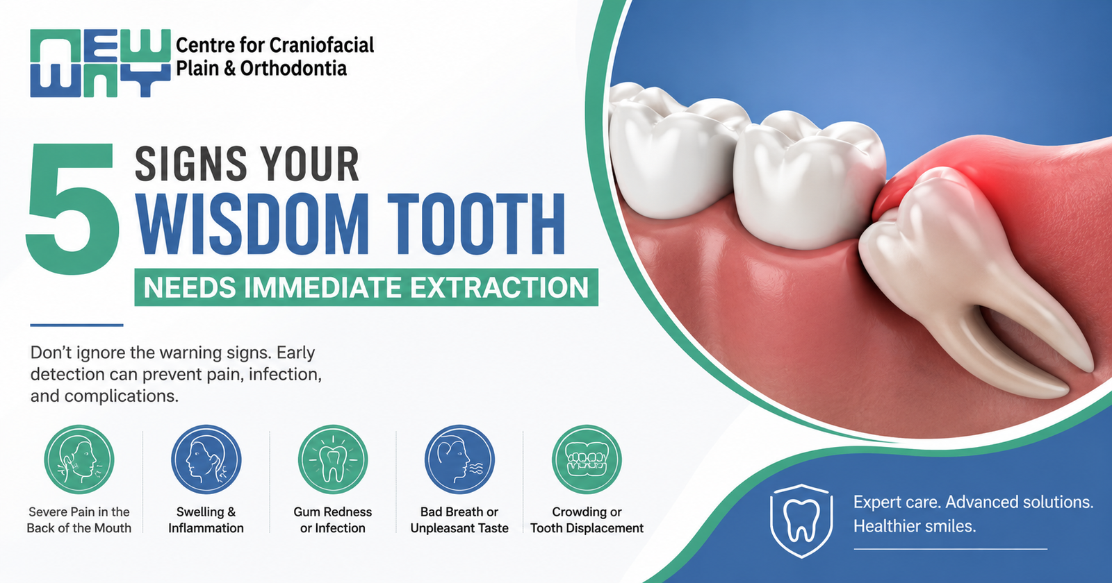 Wisdom tooth extraction in Mohali