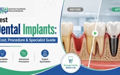 Dental Implants in Chandigarh