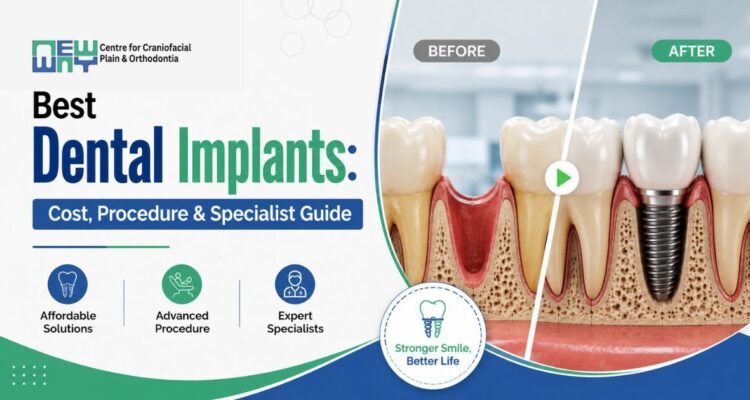 Dental Implants in Chandigarh