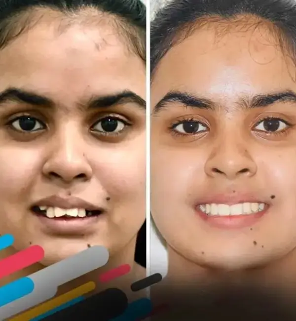 21