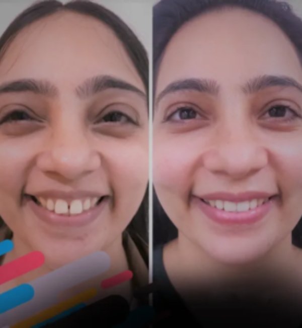 22