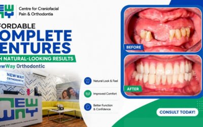 Affordable Complete Dentures in Mohali with Natural-Looking Results at NewWay Orthodontic