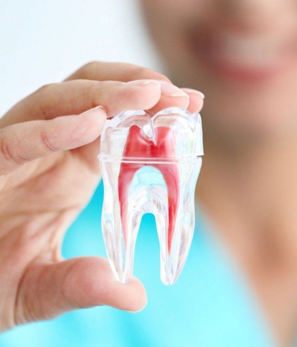 Root Canal