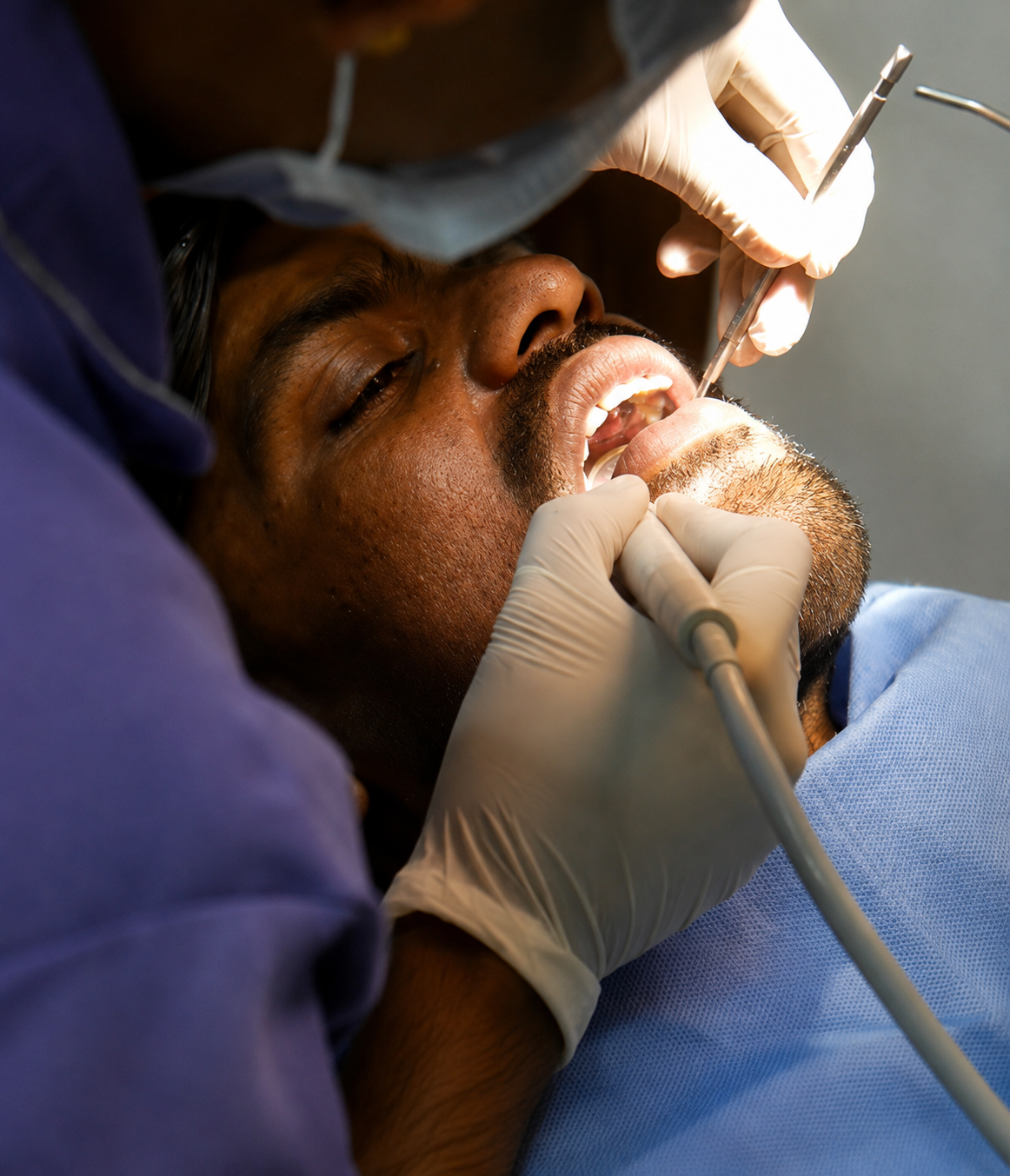 Root Canal