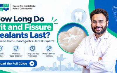 Pit and Fissure Sealant