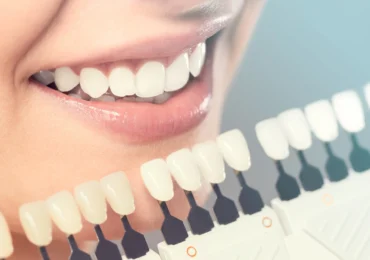 Cosmetic Dentistry
