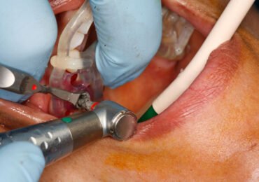Dental Surgery