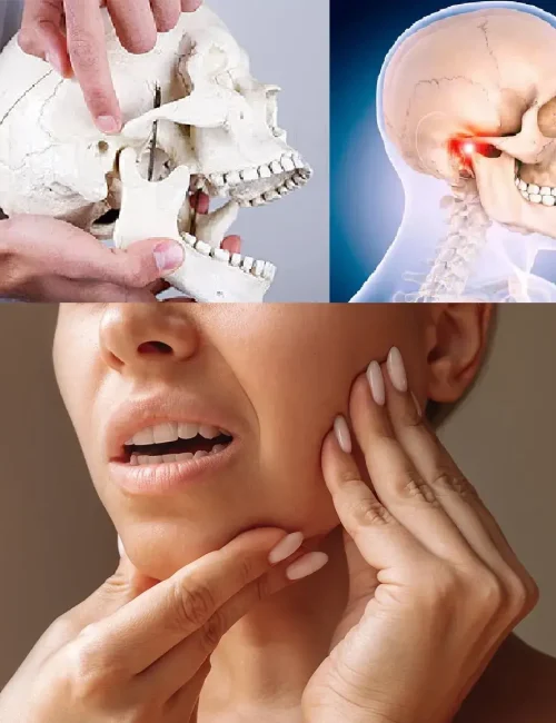 Tmj-temporomandibular-joint-disorder-pain (1)